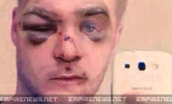 UN HOMME SE FAIT TABASSER APRÈS AVOIR POSTÉ UNE VIDÉO DE LUI FRAPPANT UN CHIEN SUR INTERNET