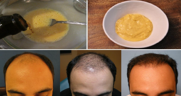 Il a mélangé 3 Ingrédients et appliqué à ses cheveux! Les résultats après 7 jours ... Incroyable!
