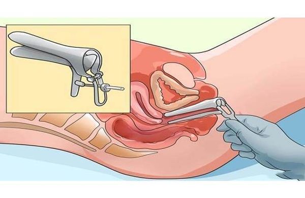 7 CHOSES QUE LES FEMMES FONT, MAIS NE SONT PAS APPROUVÉS PAR LEUR GYNÉCOLOGUE!