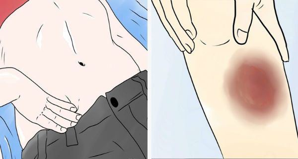 LES 20 SYMPTÔMES COMMUNS DU CANCER QUE PRESQUE CHAQUE FEMME IGNORE