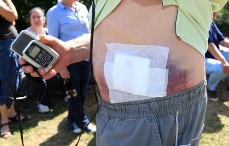 Un journaliste cible d'un tir de flash ball policier