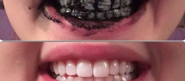 Incroyable ingrédient qui désintoxique le corps et de blanchiment des dents
