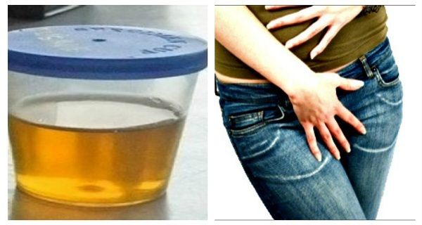 Débarrassez-vous des infections urinaires avec ce facile Débarrassez-vous des infections urinaires avec ce facile