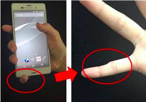 La tenue de votre Smartphone Comme cela pourrait conduire à un doigt déformé!