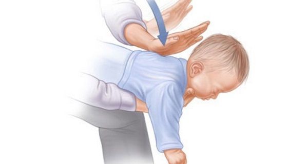 le cauchemar de tout PARENT: comment sauver votre bébé de CHOKING DANS LES 3 MINUTES - regarder la vidéo!