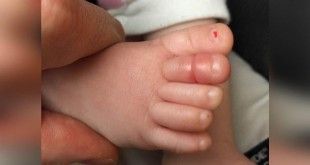 Le bébé ne serait pas arrêter de pleurer. Et leurs parents ont vu cela dans son gros orteil. Tout le monde doit savoir ce danger!