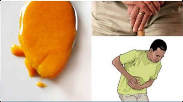 Tout ce que vous devez savoir sur CURCUMA