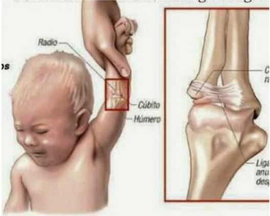 Attention! Voici la raison pour laquelle il ne faut jamais tirer le bras de votre enfant