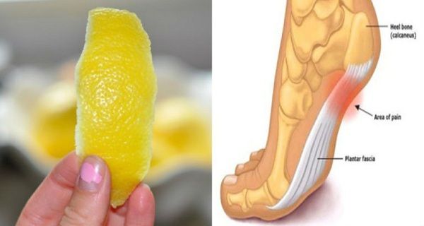 1 zeste de citron astuce pour se débarrasser de l'inflammation et de la douleur chronique