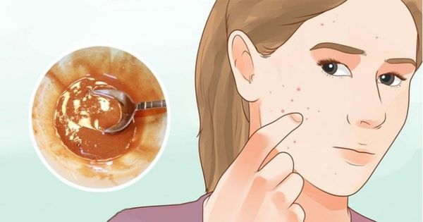 CE MASQUE SUPPRIME NATURELLEMENT TACHES, CICATRICES D'ACNÉ ET LES RIDES APRÈS LA DEUXIÈME UTILISATION