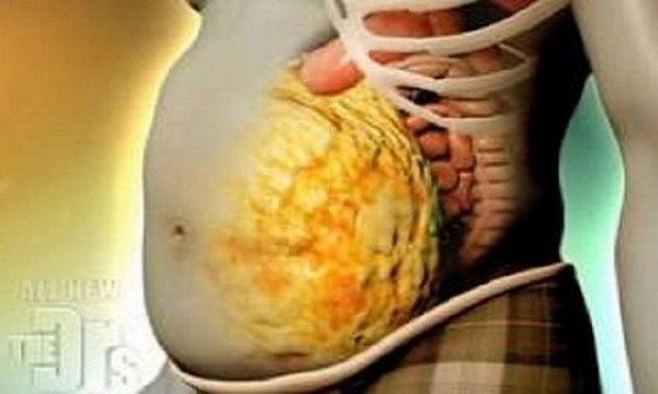 Vous voulez accélérer votre métabolisme, éliminer les toxines de votre corps et perdre du poids? Essayez cette recette simple et efficace Voir les résultats étonnants en 72 heures!
