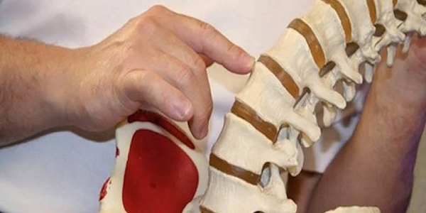 Astonishing remède naturel pour traiter l'arthrite, la sciatique Nerve douleur, Rhumatisme, Genou Sore, Et les douleurs articulaires!