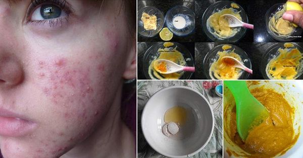 Les boutons sur la personne sur quoi la mère