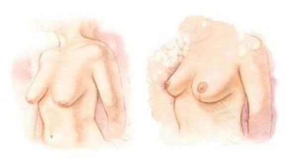 Serrez vos seins en 2 étapes
