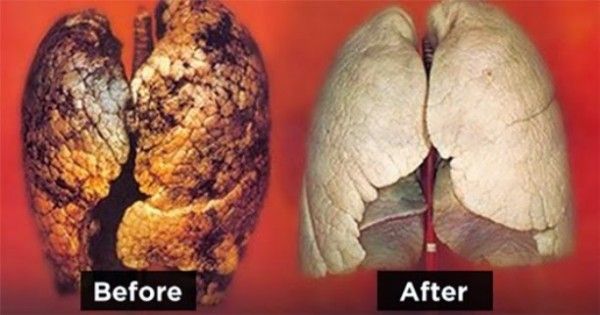 LA MEILLEURE FAÇON NATURELLE POUR EFFACER VOS POUMONS DE NICOTINE ET DE GOUDRON