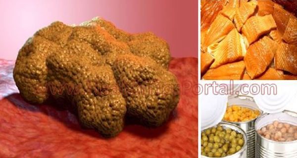 CES ALIMENTS RENDENT LES CELLULES CANCÉREUSES SE DÉVELOPPENT DANS VOTRE CORPS! ARRÊTEZ DE LES MANGER POUR ÉVITER LE CANCER!