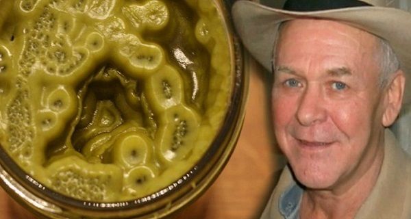 MAN GUERI 5000 PERSONNES DU CANCER; CECI EST UNE RECETTE QUI TUE TOUS LES TYPES DE TUMEUR EN 90 JOURS - VIDEO