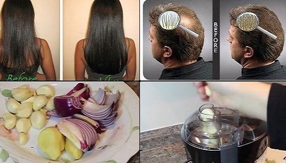Remèdes naturels pour les cheveux fins! Incroyable!