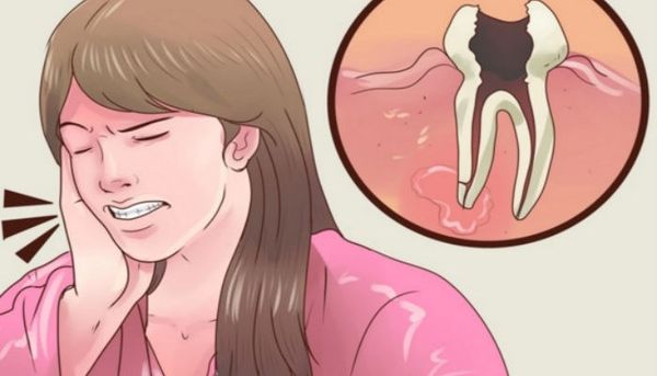 RINCEZ VOTRE BOUCHE PENDANT 1 MINUTE ET RETIRER CE TARTRE ET L'ACCUMULATION DE PLAQUE DENTS POUR TOUJOURS!