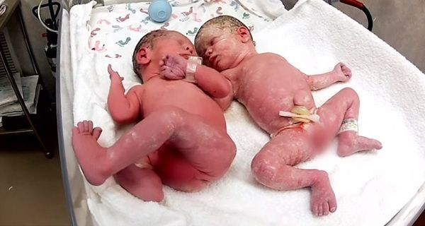 Nouveau-né Twins Cried Jusqu'à ce que les médecins mettre ensemble. Puis ce qui est arrivé Video Incroyableles