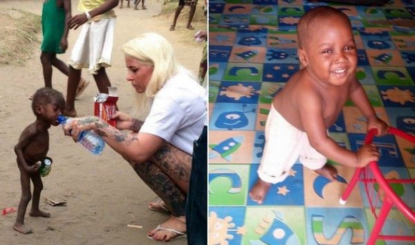 Remember The Boy Who a failli mourir de faim? Voir à quoi il ressemble aujourd'hui! (Photos)
