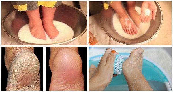 Ne pas dépenser votre argent sur Pédicure: Utilisez Deux ingrédients de votre cuisine et vos pieds look sympa