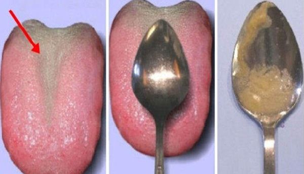 CONNAÎTRE LA SANTÉ DE VOS ORGANES INTERNES AVEC CETTE SIMPLE ASTUCE. FACILE ET EFFICACE!