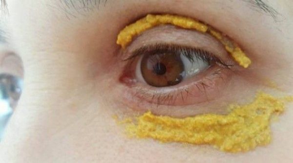 Elle Met Curcuma autour des yeux, et 5 jours plus tard, quelque chose d'incroyable est arrivé!