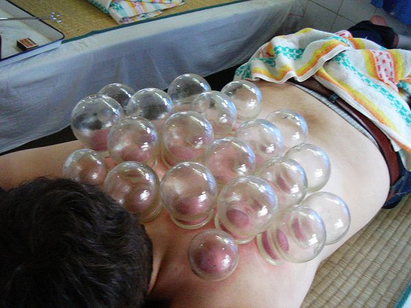 5 raisons importantes à faire Cupping