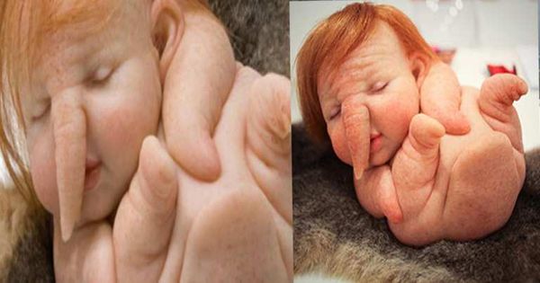 Une femme norvégienne donne naissance à Baby Elephant! OMG