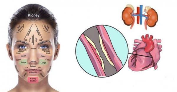Si le visage est couvert de diverses choses, il dit beaucoup sur la santé du foie, les reins et les hormones