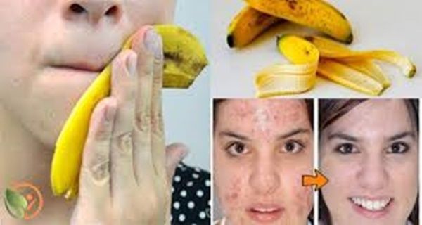 Arrêtez de jeter des pelures de bananes: 10 façons vous pouvez les utiliser!