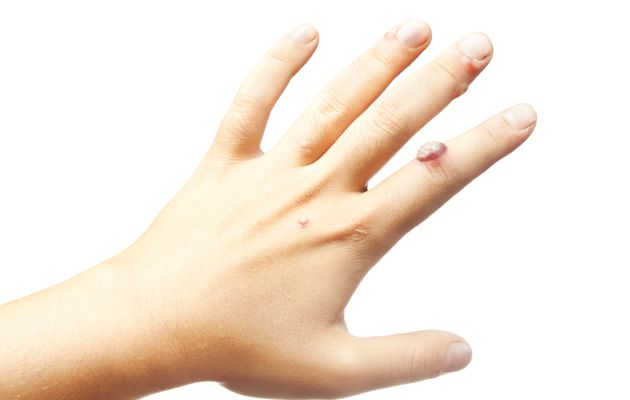 Astuces Beauté, Santé et Maison - Recettes, remèdes Astuces Beauté, Santé et Maison - Recettes, remèdes