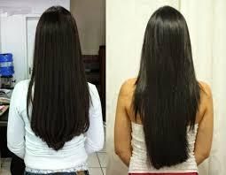 La prévention de la chute des cheveux chez les femmes
