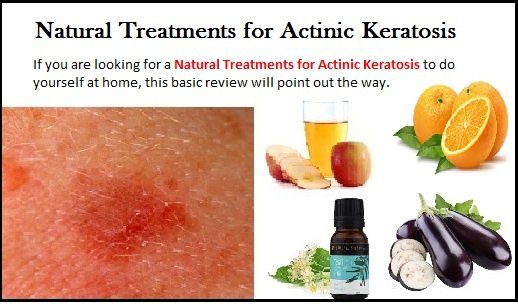 Actinic Keratosis