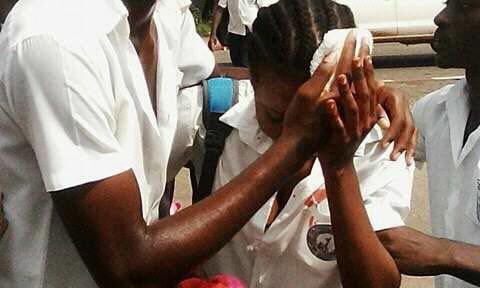 Une jeune élève blessée par la police au service d'Ali Bongo