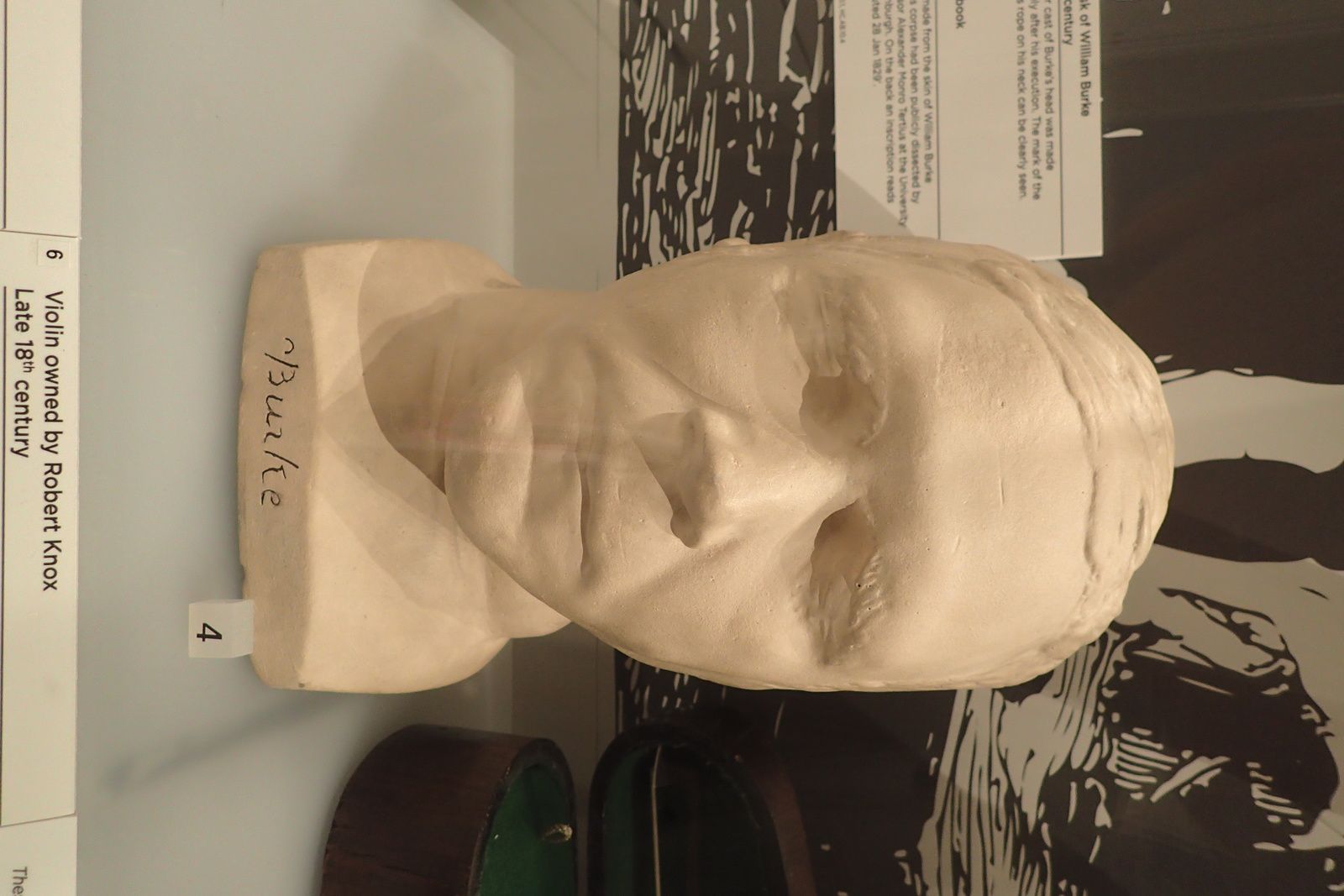 masque mortuaire Williamn Burke edinburgh Surgeon's Hall Museum
