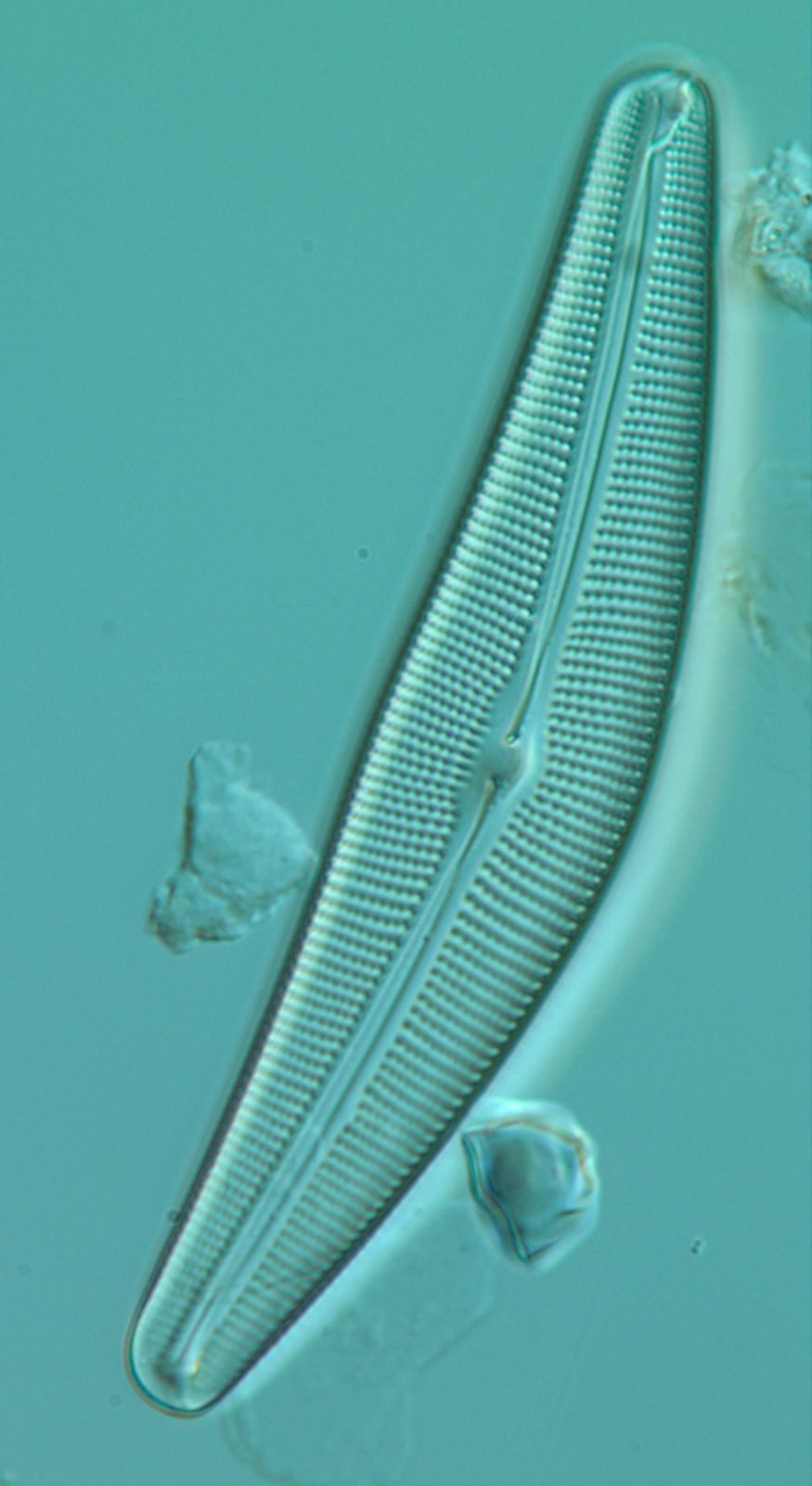 Une diatomée grossie 1000 fois. Il s'agit de l'espèce Cymbella aspera (taille moyenne : 110 µm de long et 25 µm de large) - photo d'Olivier Herlory