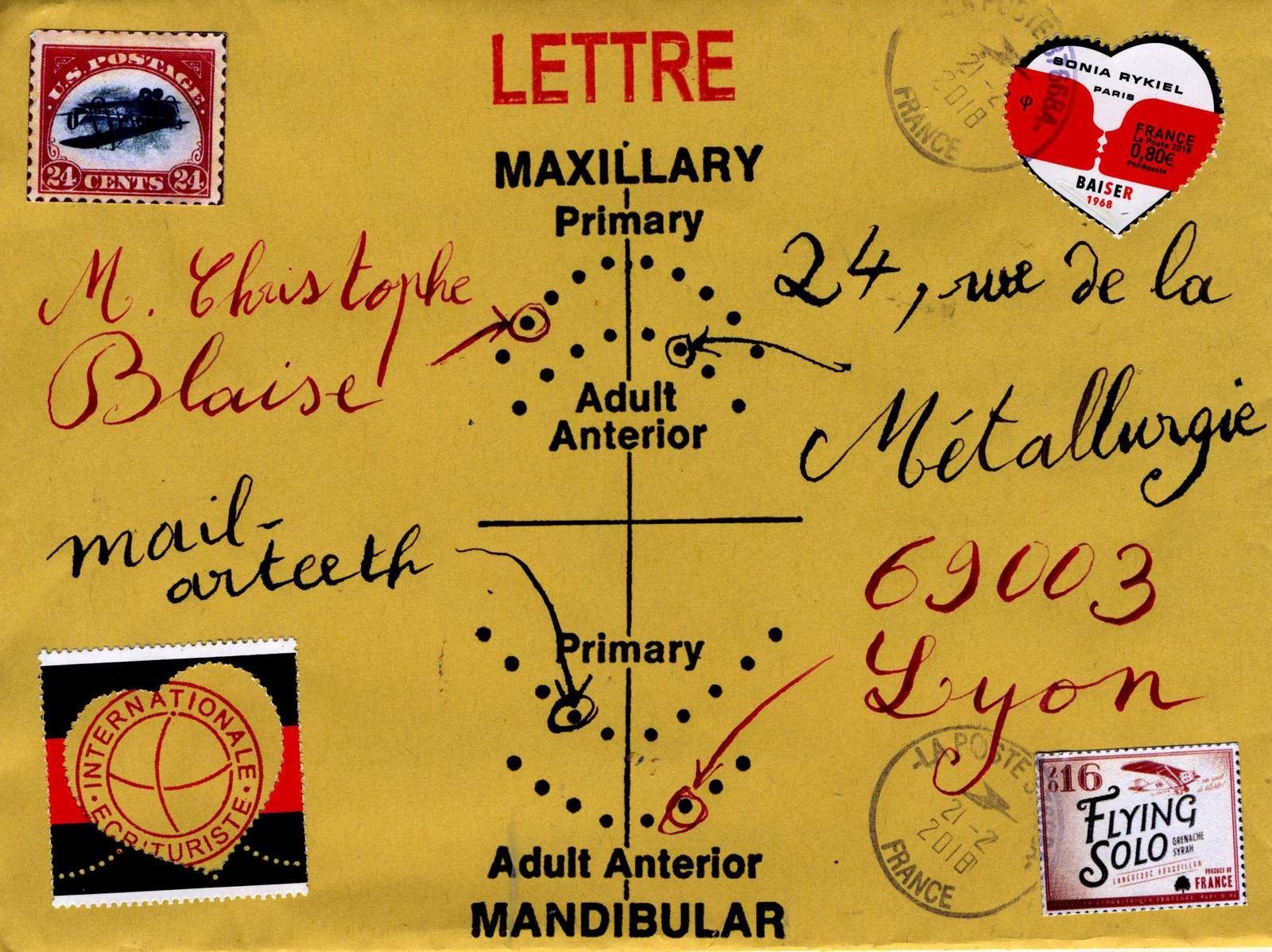 dents du haut en 4 lettres