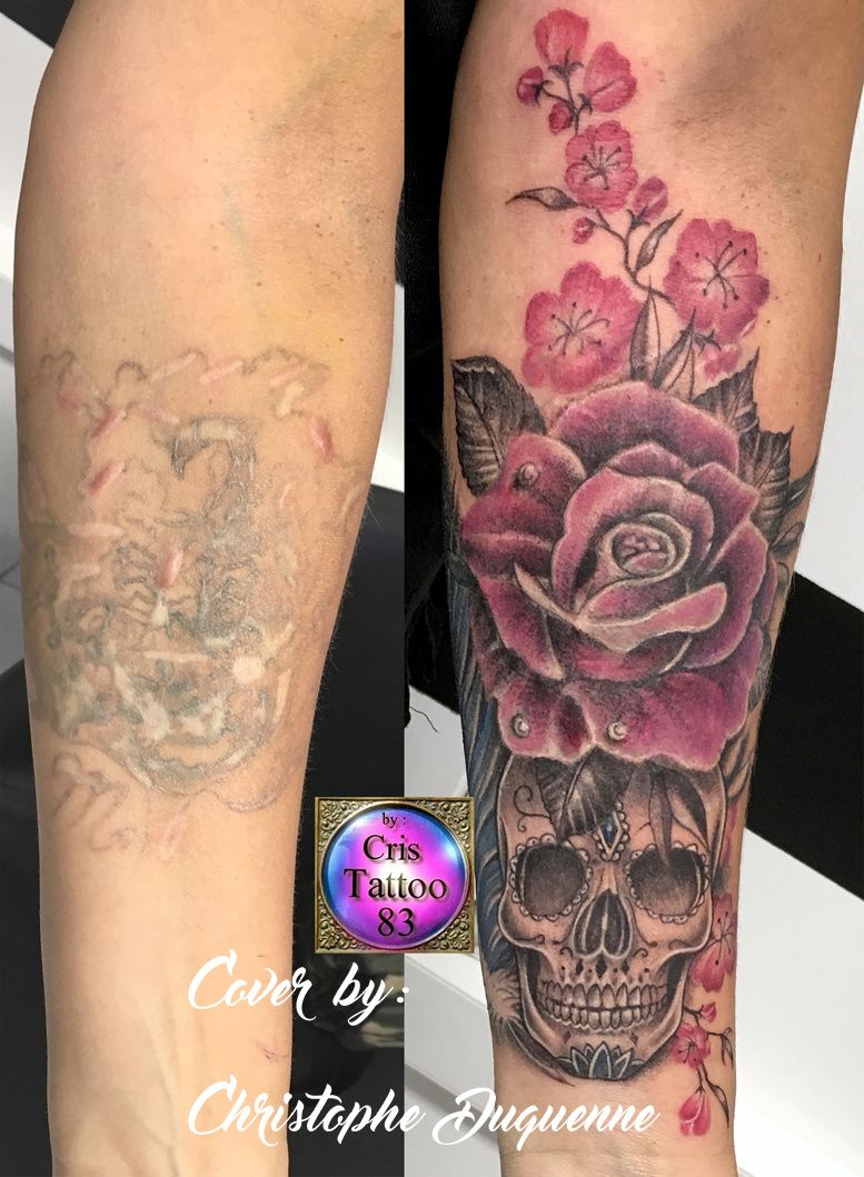Recouvrement anciens tatouages
