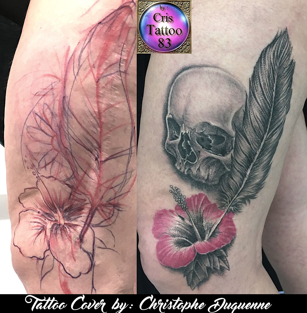 Recouvrement cicatrices