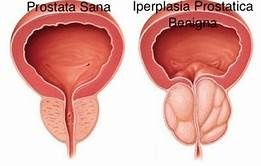 formule prostate laboratoire cellinnov formule prostate laboratoire cellinnov