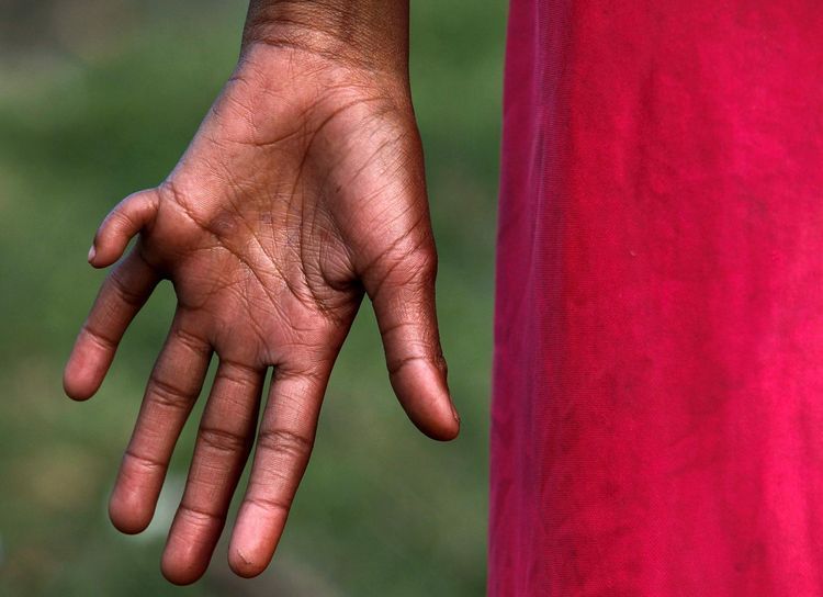 Un enfant de 11 ans dont la mère vit dans un bidonville près du site d'Union Carbide, exposée à l'eau contaminée. (Photo Reinhard Krause. Reuters)