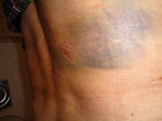 Nur soviel, weil ich schon wieder mit dem Hinweis belegt wurde: Du wirst ja immer langsamer... . Fußgänger ticken nun mal anders. Samstag Abend vor dem Lauf, aus gut 1 Meter Höhe fiel die Leiter einfach um... zu dumm. Autschen bis heute. Ich weiß jetzt, dass mal viele Muskeln benötigt, sich in der Nacht einmal umzudrehn. Schmerz ist Schwäche, die auf 42 Km den Körper verläßt!