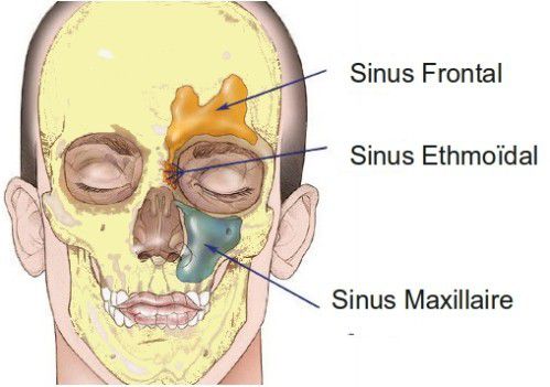 Sinusite maxillaire : symptômes, causes et traitement