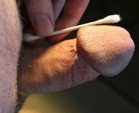 Problème d'image trop petite : la solution