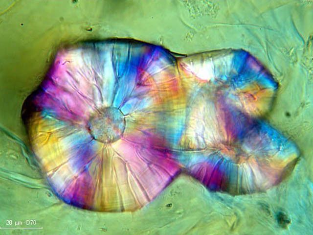 Cellules pierreuses de la poire vues au microscope taille environ 0,15 mm Photos Christian Aubert