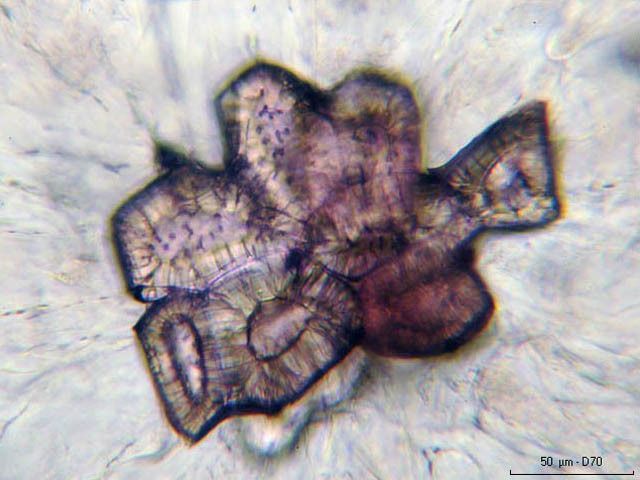 Cellules pierreuses de la poire vues au microscope taille environ 0,15 mm Photos Christian Aubert