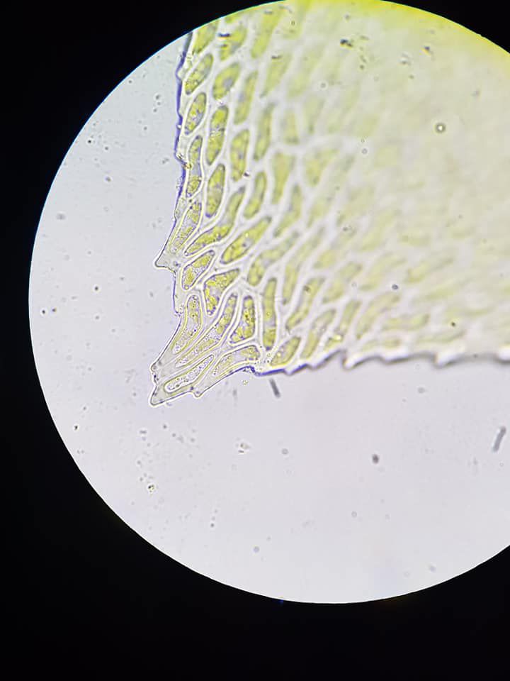 cellules de la marge, de l'apex et 2 photos de cellules allaires d'Alleniella complanata-au microscope X1000-  Photos Gilles Weiskircher (Anab)