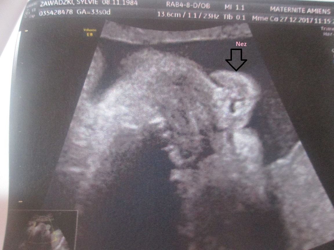 Ma Grossesse 35 Semaines Derniere Ligne Droite Avant Notre Rencontre Maman Et Soignante En Picardie
